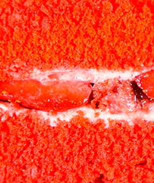 Аветон. Косметический ремонт